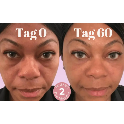 DermaLift™ – Nasolabialfalten Mikrokristalline Lifting Maske
