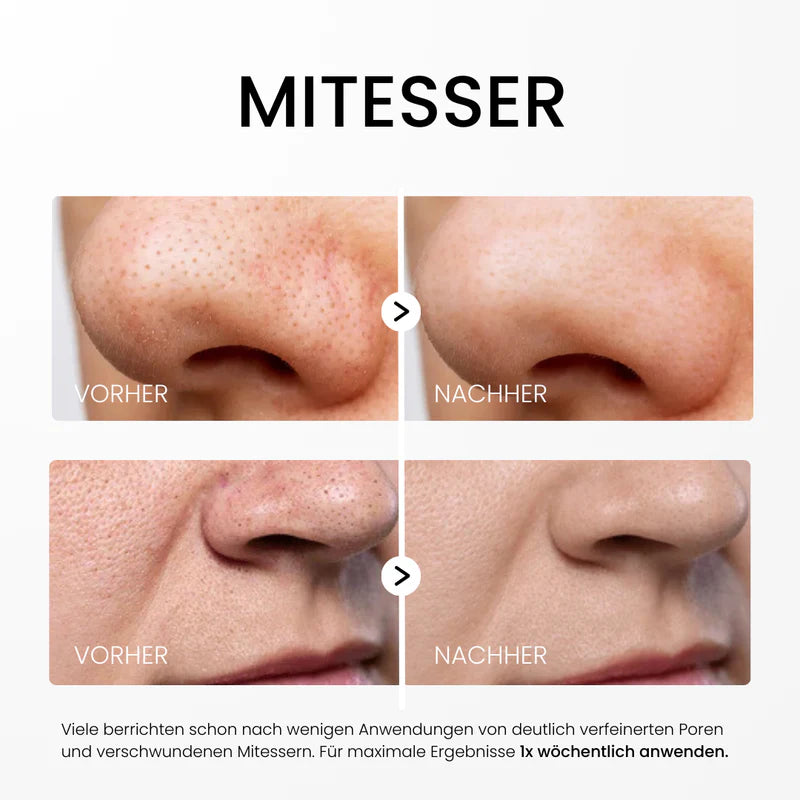 Reisora™ – Innovatives Reis-Peeling-Serum für glatte & strahlende Haut