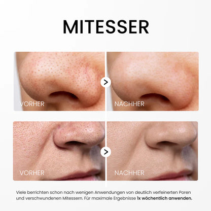 Reisora™ – Innovatives Reis-Peeling-Serum für glatte & strahlende Haut