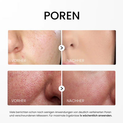 Reisora™ – Innovatives Reis-Peeling-Serum für glatte & strahlende Haut